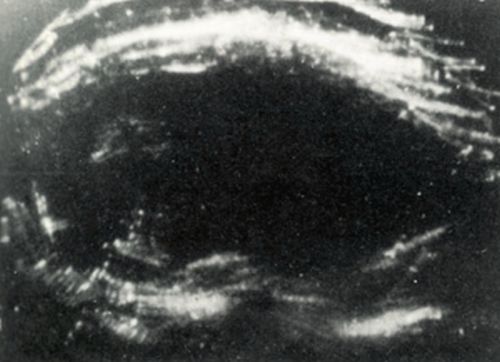 1614464d.jpg